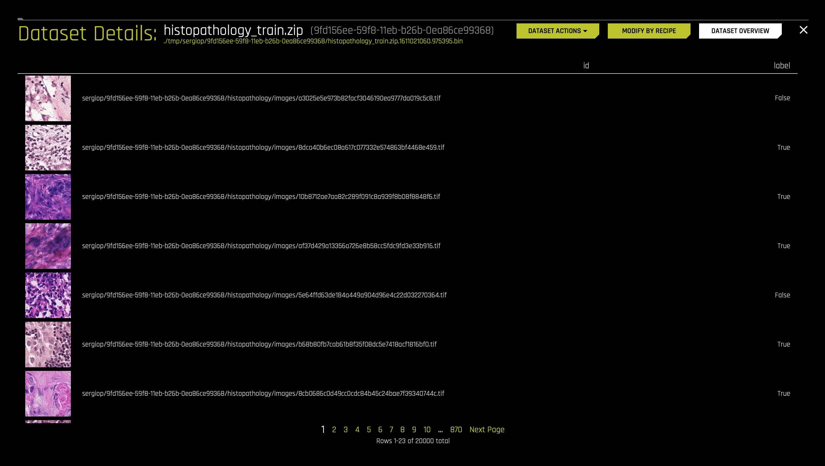 metastic-cancer-dataset-details